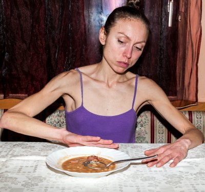 Anorexia is a serious mental health concern for troubled teen girls